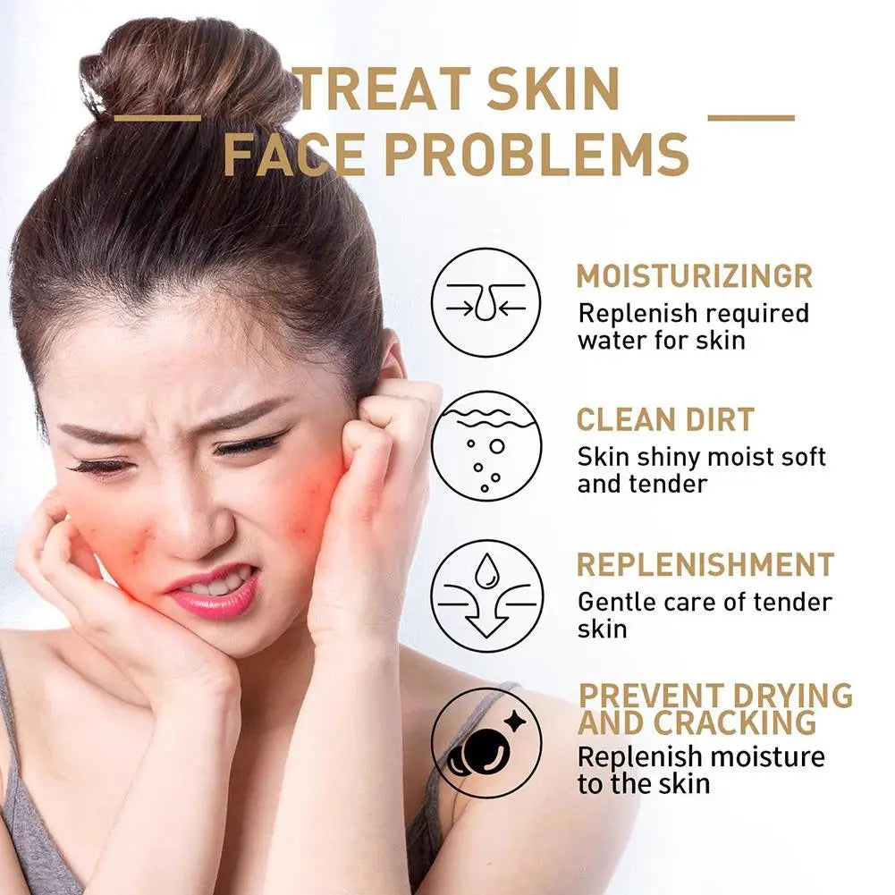 Anua Rice 70 Glow Milky Toner With 70% Rice Water