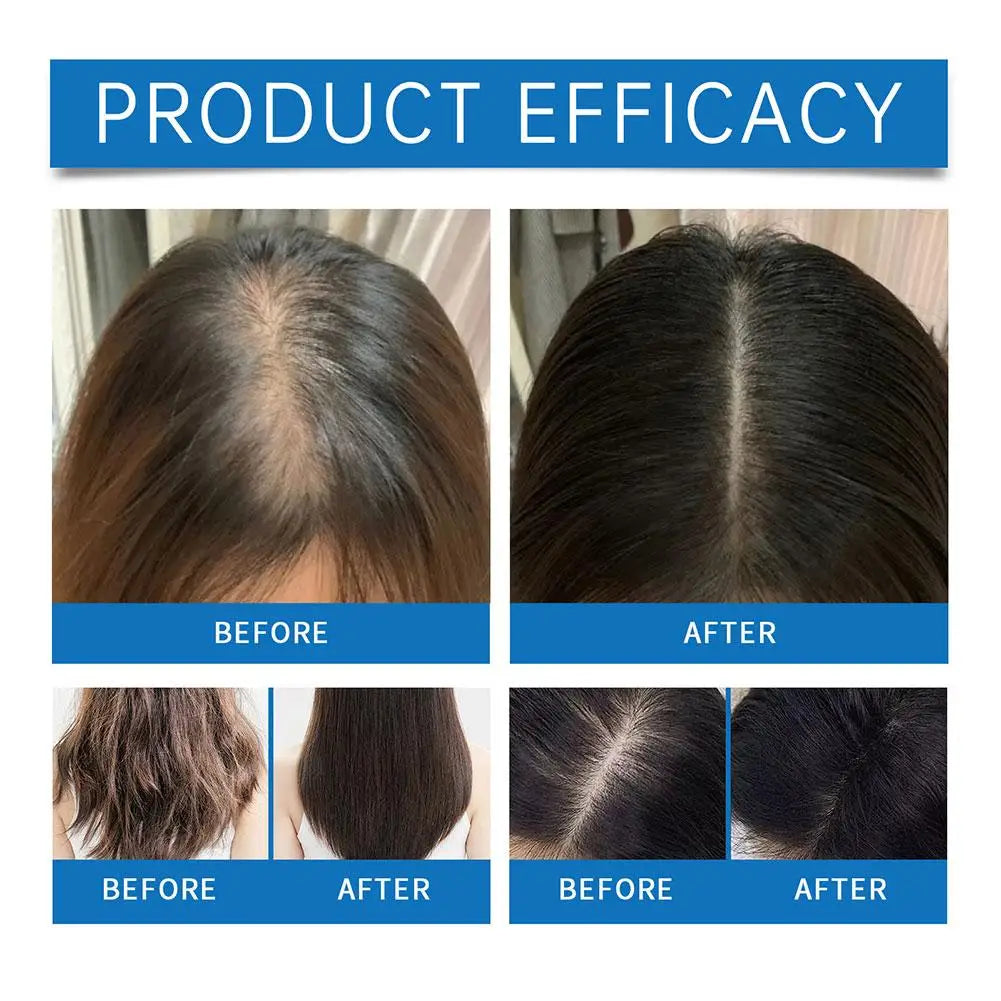 Hoegoa Scalp Ampoule