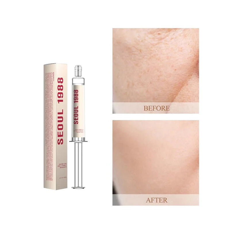 Seoul 1988 Eye Serum