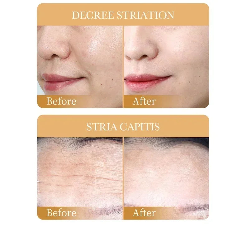 SADOER Collagen Anti-Aging Face Mask