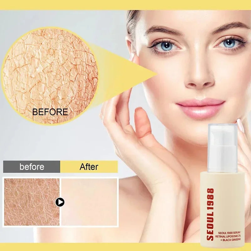 Seoul 1988 Retinal Serum