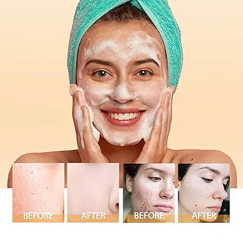 SADOER Vitamin C Cleanser