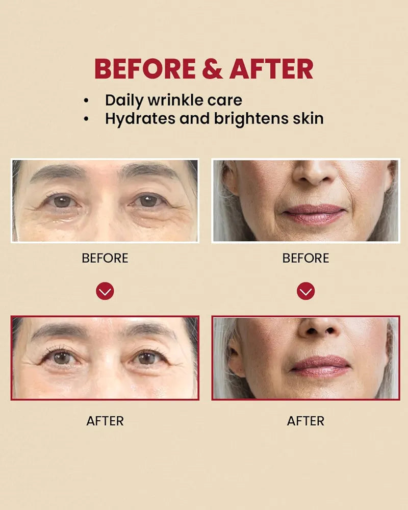Seoul 1988 Retinal Cream