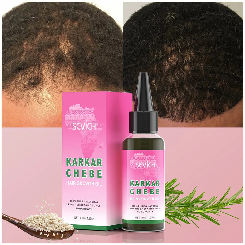 Sevich Karkar Chebe Hair Oil Batana Butter