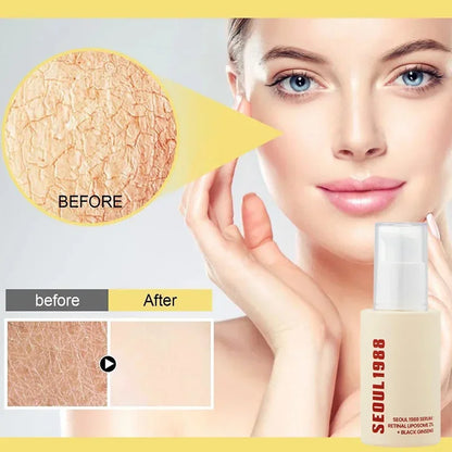 Seoul 1988 Retinal Serum